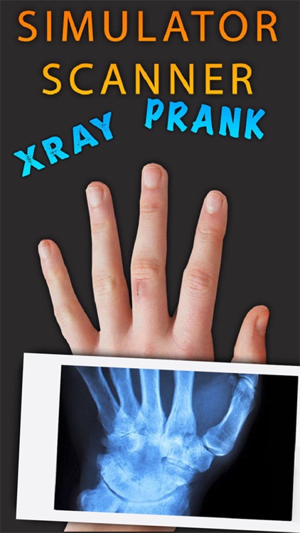 Simulator X-Ray Hand