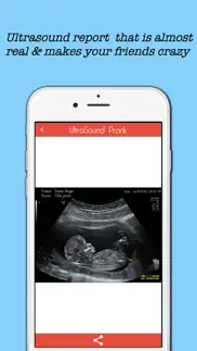 How to cancel & delete baby ultrasound spoof 3