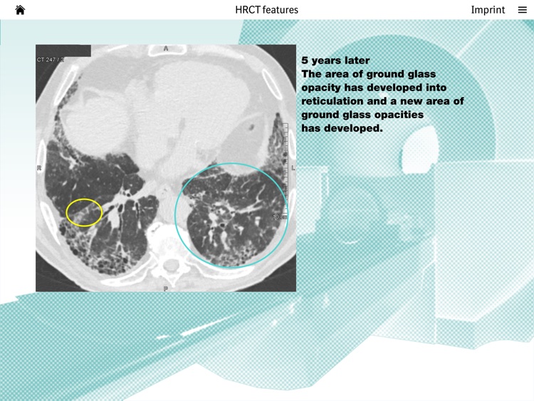Images of ILD screenshot-3