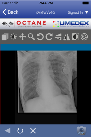 UMEDEX OCTANE App Suite screenshot 4