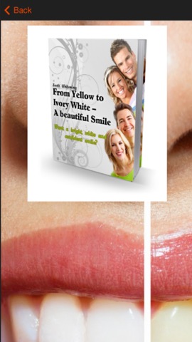 Teeth Whitening Tips - Learn How to Whiten Teethのおすすめ画像3