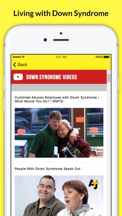 Living with Down Syndrome - Facts and Symptoms