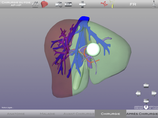 Screenshot #5 pour Chirurgie du foie AP-HP