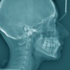 Oral Radiology