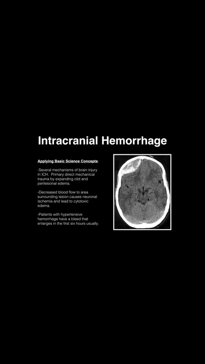 Neurology Blueprint PANCE PANRE Review Course