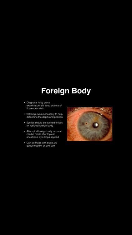 Complete PANCE/PANRE Review Course (Video Lecture and Questions) screenshot-3