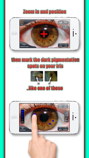 Health Test - The iridology app(圖3)-速報App