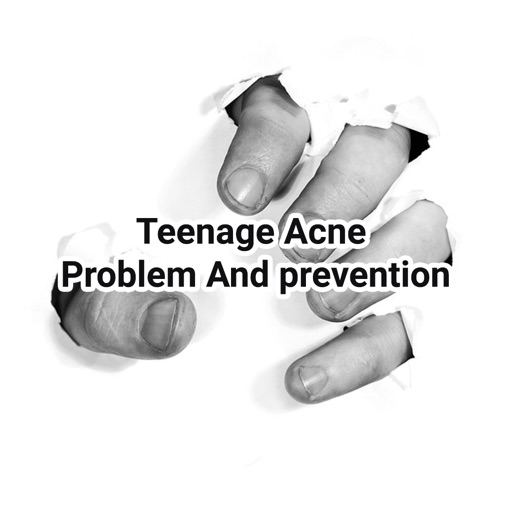 Acne Problem And Prevention