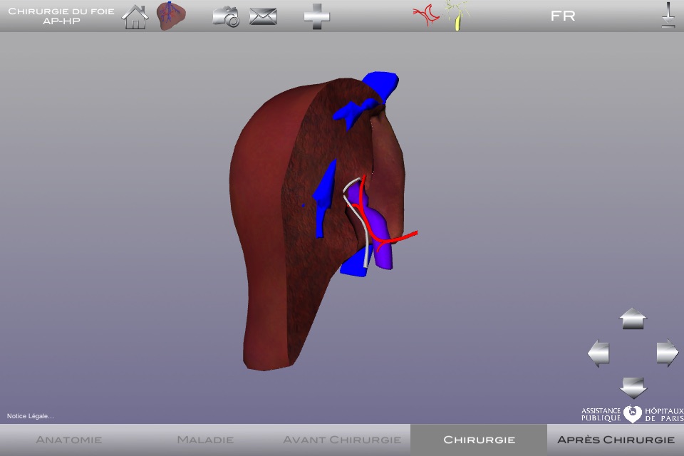 Chirurgie du foie AP-HP screenshot 3