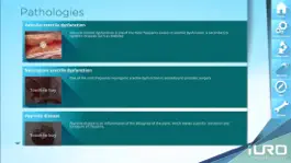 Game screenshot iURO Andrology hack