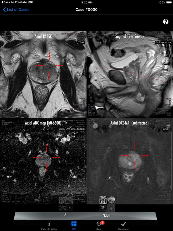 Prostate Cancer Imaging