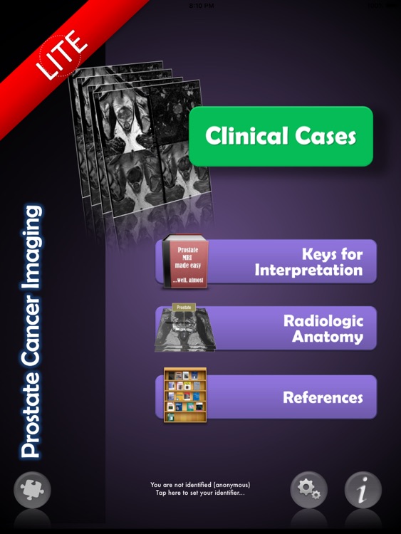 Prostate Cancer Imaging LITE