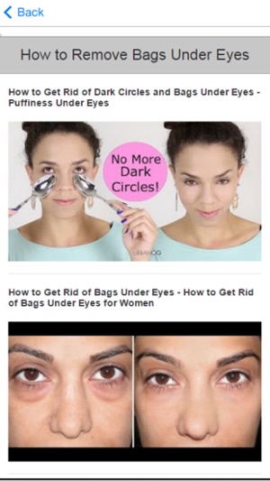 How to Get Rid of Dark Circles(圖4)-速報App