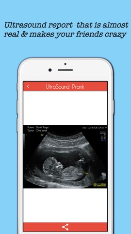 Baby Ultrasound spoofのおすすめ画像2