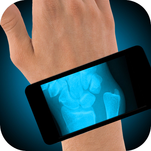 Simulator X-Ray Hand Fracture