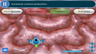 SURGERY Game USMLE Step 2のおすすめ画像3