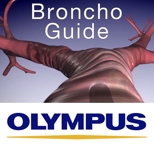 BronchoGuide