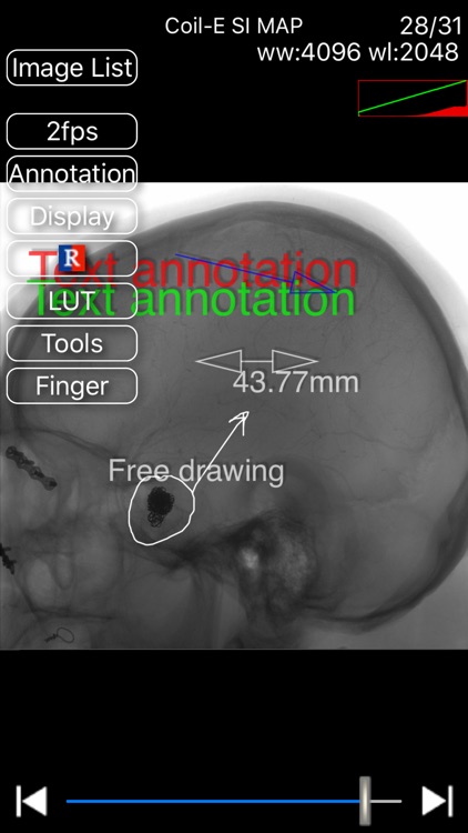 iMedViewer