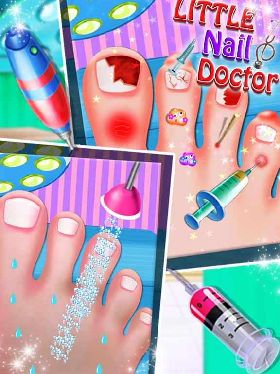 Toe Nail Doctor - Little Nail Surgery kids gamesのおすすめ画像2