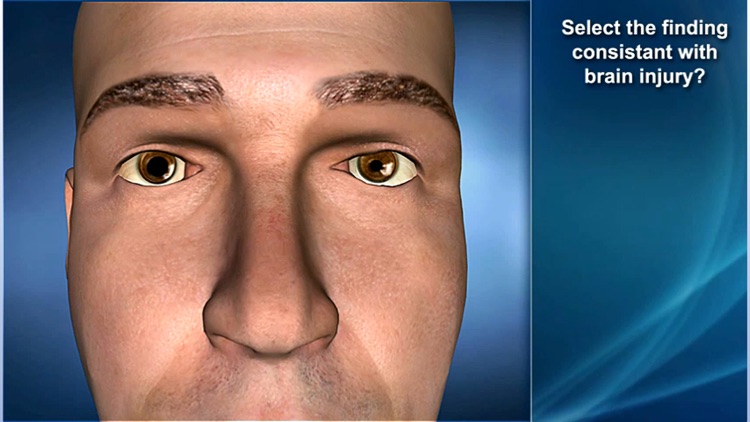 Medrills: Skull and Brain Injuries screenshot-3