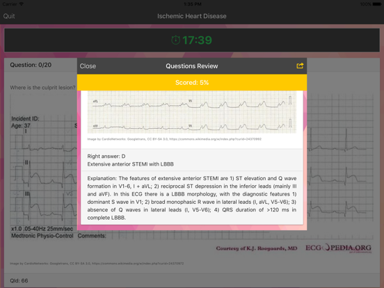 ECG Master - Quiz, Exam, Explanation, Statistic iPad screenshot 5 - Medical app
