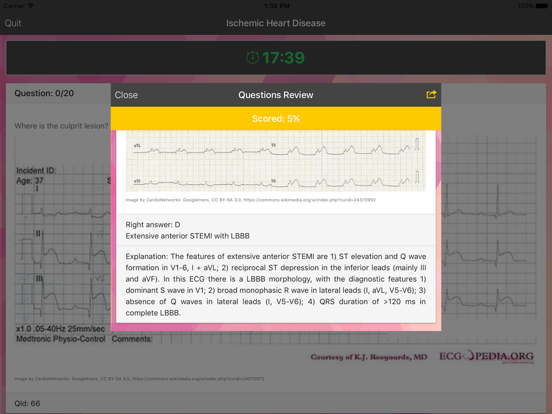 ECG Master - Quiz, Exam, Explanation, Statisticのおすすめ画像5