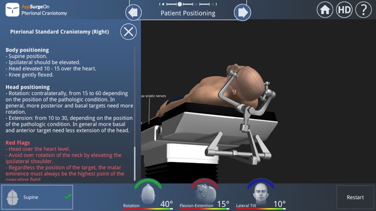 Pterional Craniotomy screenshot-3