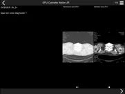 cours tdm multicoupe du thorax айпад изображения 2