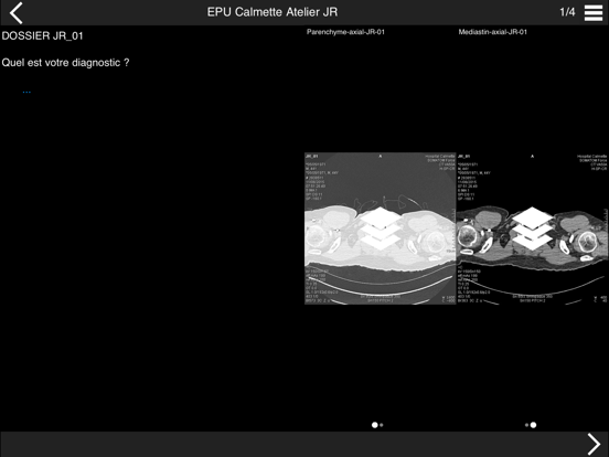 Cours TDM multicoupe du thorax screenshot 2