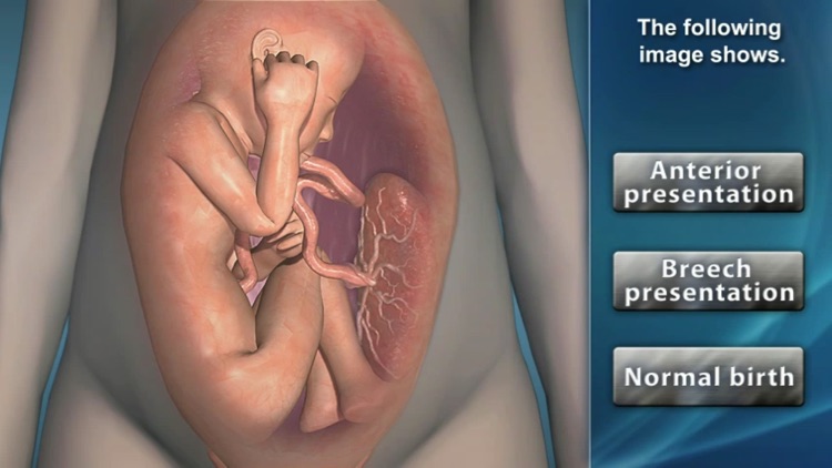 Medrills: Obstetrical Emergencies