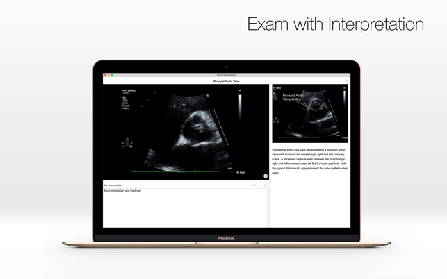 Echocardiography - Case Study and Review(圖5)-速報App