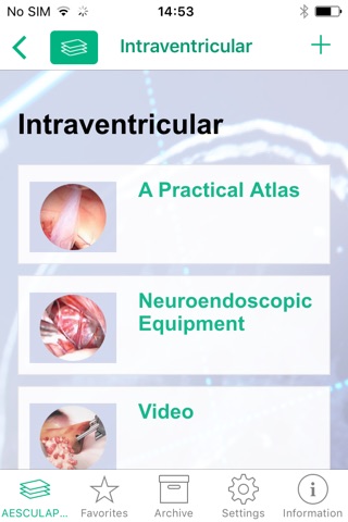 AESCULAP Neuroendoscopy screenshot 2