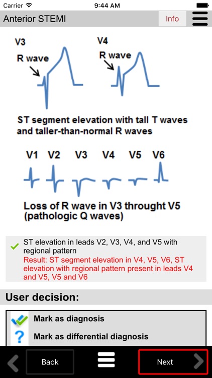 Ecg Calc screenshot-4