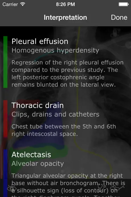 RealWorld Radiology