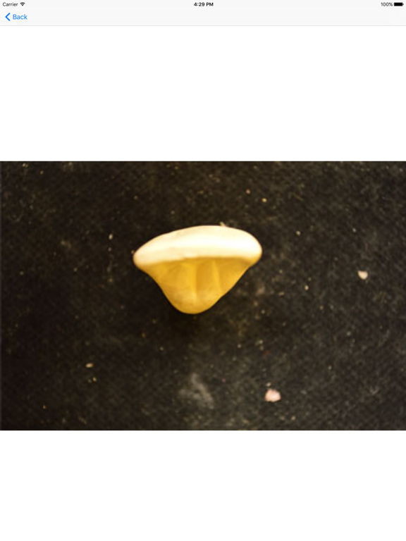 Screenshot #6 pour Tooth Morphology - Your Quick Reference Guide