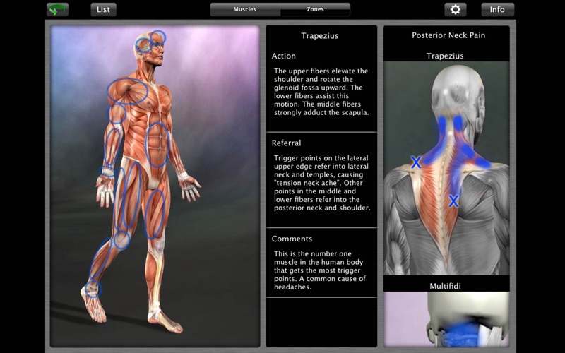 muscle trigger point anatomy iphone screenshot 1