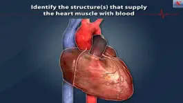 Game screenshot ArchieMD IC Health Coronary Bypass mod apk