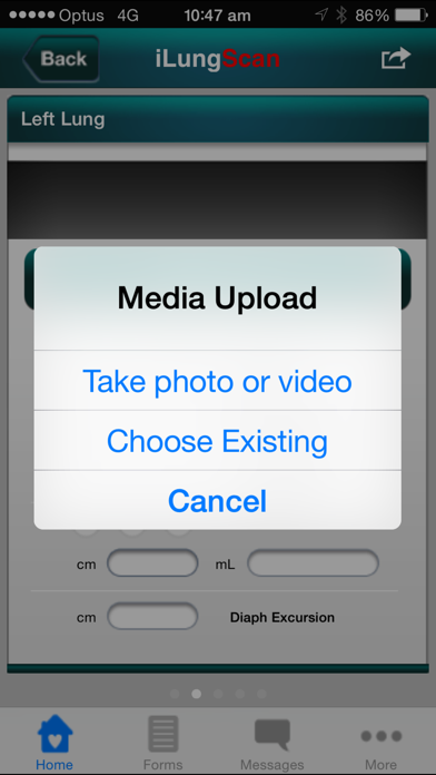 Screenshot #3 pour iLungScan™