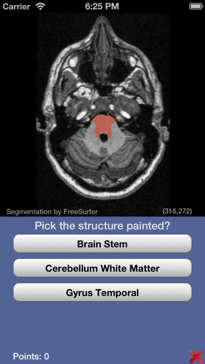 iSurf BrainView screenshot-3