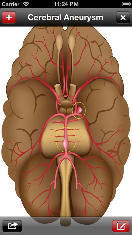 Med Sketch: Anatomy Drawing App