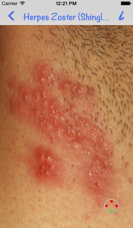 Dermatology by AIMapps screenshot-4