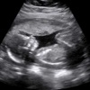 Baby Ultrasound 2015 - iPhoneアプリ