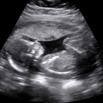 Download Baby Ultrasound 2015 app