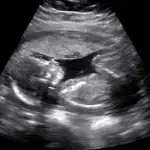 Baby Ultrasound 2015 App Contact