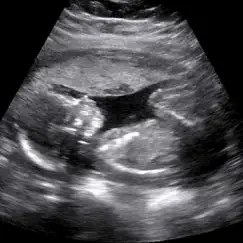 baby ultrasound 2015 not working