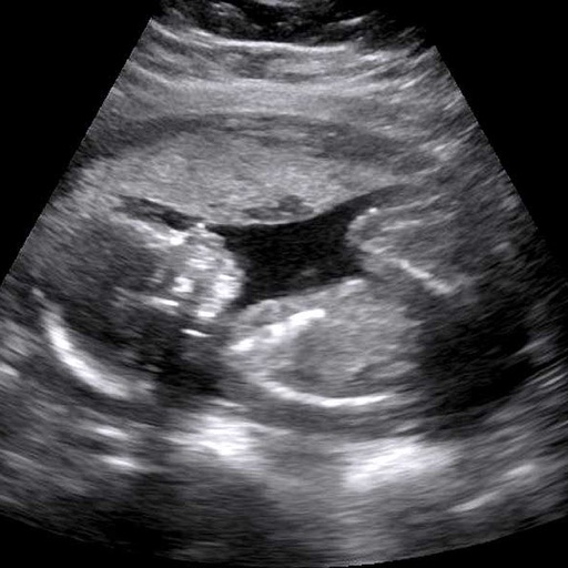 Baby Ultrasound 2015 Icon