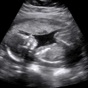 Baby Ultrasound 2015 app download