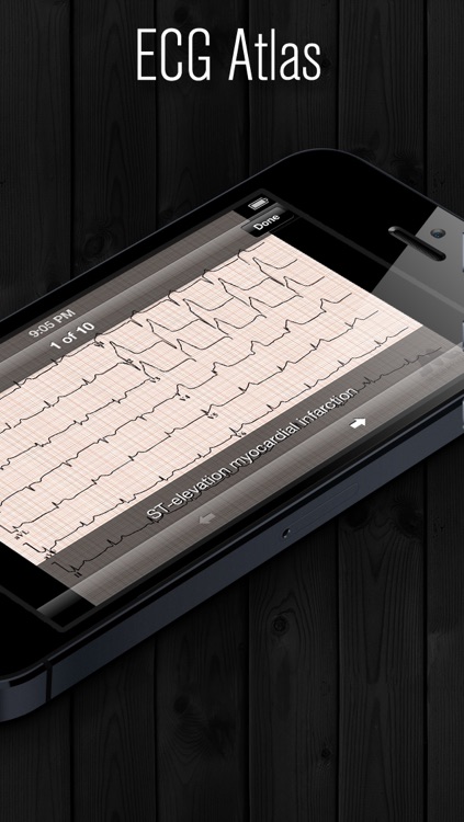 ECG Atlas