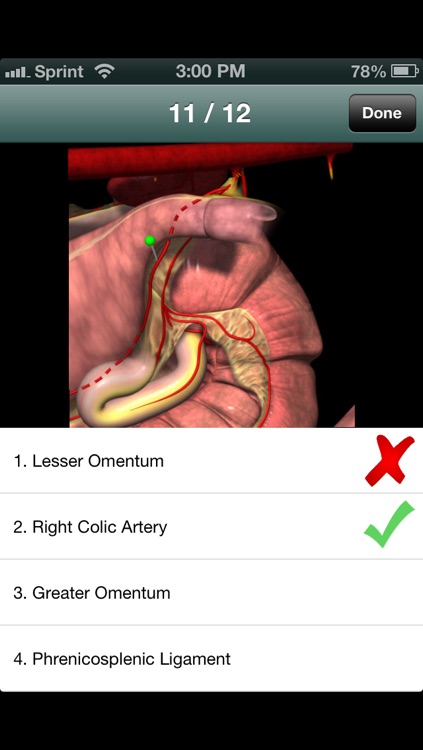 Equine GI & Abdomen Flashcards screenshot-3