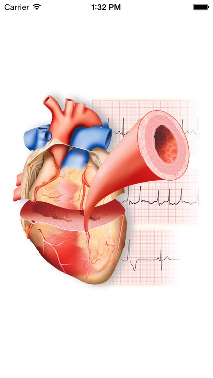 Miniatlas Cardiology
